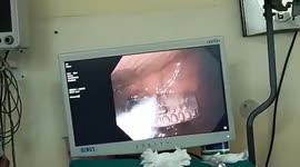 Hard to stomach! Inmate swallows phone ahead of search in Indian prison
