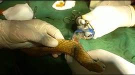 Doctors pull out discarded plastic cap from cobra in India