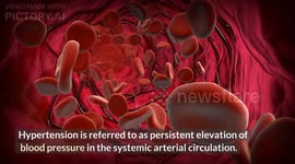 Hypertension (High Blood Pressure) - Causes, Types, Risk Factors, Signs & Symptoms, Treatment