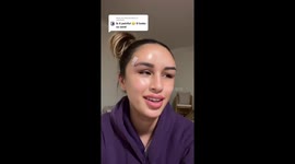 Model, 21, who looked like 'alien with horns' from botched thread lift has them REMOVED – but now 'looks like egg' PART THREE