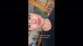 Model, 21, who looked like 'alien with horns' from botched thread lift has them REMOVED – but now 'looks like egg' PART FOUR