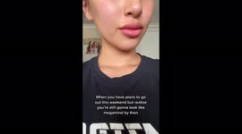 Model, 21, who looked like 'alien with horns' from botched thread lift has them REMOVED – but now 'looks like egg' PART FIVE