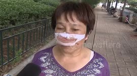 Man bites and swallows wife's nose in shocking attack