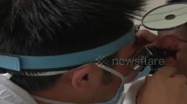 EDT Centipede climbs into woman's ear while she's asleep
