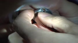 Firemen remove metal ring from toddler's finger