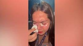 Woman left in tears after eyelash extension remover is stuck on her lashes