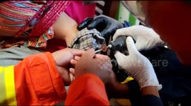 Firefighters use saw to cut free toddler's foot from drain filter in Indonesia