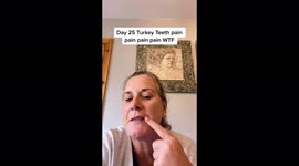 Woman, 48, left devastated flying 2,000 miles to get new teeth – but now risks losing them all.