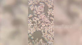US student captures mesmerising videos of snails, tooth plaque and BLOOD under microscope
