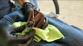 Rescued bat receives mani-pedi from sanctuary volunteer in Israel