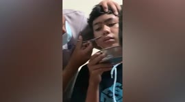 Live leech pulled from boy's nose in Indonesia