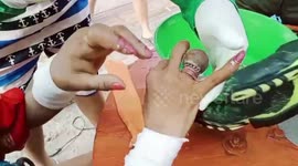 Firemen battle to remove ring that was stuck in homeless woman's finger for a year