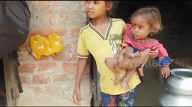 A 2 Year Old Girl With Four Arms And Legs extra arms and legs sticking out of her waist
