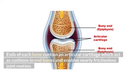 Osteoarthritis - Causes, Risk Factors, Signs & Symptoms, Diagnosis, Treatment & Prevention