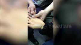 UK woman's engagement ring cut off by firefighters after it got stuck and made her finger turn purple