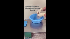'Did her body FRY them?': TikTok doctor leaves users shocked ripping open 30-year-old silicone breast implants Part 2