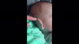 The baby's ears curled into a tube during sleep!