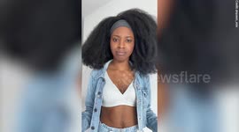 Woman with chest hair embraces her appearance and has never felt more confident