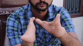 Indian man born without fingers is now accomplished sketch artist