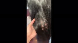 Hairdresser shares extreme lice infestation in client’s hair – revealing thousands of eggs