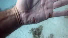 Diver's hand left covered in patches after accidentally touching Crown-of-thorns starfish in Mauritius