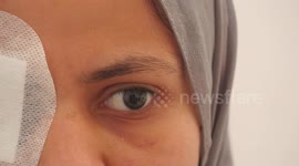 Palestinian Eman Abu Jasser, 22, who wounded in one of her eyes by Israeli airstrike during the latest Israel-Gaza conflict, in Jabalia in the northern of Gaza strip