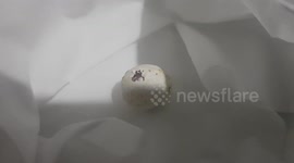 Baby parrot struggling to hatch pulled out of egg using tweezers