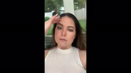 Woman, 20, 'nearly dies' from severe allergic reaction to HAIR DYE. Part 3