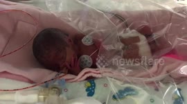 Baby survives against the odds after being born weighing just 1lbs 2oz - the same as a loaf of bread