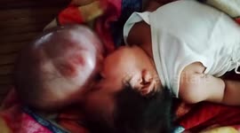Filipino parents raise money as son is left with huge sac of skin hanging from head