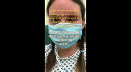 One-eyed Sheffield mum has leg skin graft covering empty socket – producing own HAIR and BLOOD SUPPLY Part 2