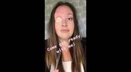 One-eyed Sheffield mum has leg skin graft covering empty socket – producing own HAIR and BLOOD SUPPLY Part 4