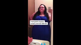 'I had full body makeover after 21-STONE weight loss left me with saggy skin – people say I'm unrecognisable,' says woman, 35 Part 2
