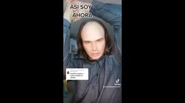 Lad trolled for bald head leaves social media stunned in CATFISH transformation Part 1