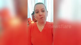 Woman born with cleft lip and palate asked people to avoid featuring scars and burns in their Halloween costumes