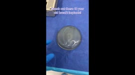 'They’ve been well seasoned': TikTok doctor leaves viewers confused revealing 18-year-old YELLOW breast implants