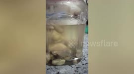 Unusual medical sighting of 8 underdeveloped fetuses found in 22-day-old baby's stomach in eastern India