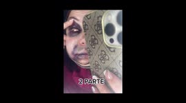 Woman shares horrific video of her face after cosmetic surgery complications. Part 2