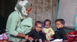 India's Three brothers suffer from a rare disease that makes them look like A Child