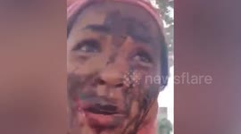 Police hunt two Polish tourists over brutal acid torture attack on beautiful Khmer woman  in Thailand