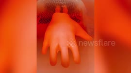 New Video: Bioengineers have devised way of growing skin in the shape of HANDS
