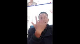 Kenyan man has 6 fully functional fingers on both hands