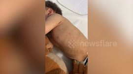 Boy, four, struggling to breathe and covered in sores from black mould in housing association home
