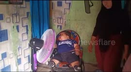Obese Baby 27 Kilograms, Minister of Health Promises to Give Treatment at Hospital West Java Indonesia