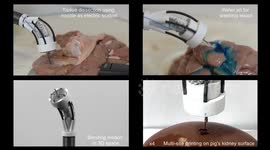 New robot can 3D bioprint inside human body