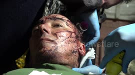 Military field hospital treats wounded Ukrainian soldiers in Donetsk Oblast