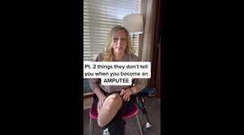 ‘I lost my leg to FLESH-EATING BACTERIA after falling over while playing with my kids,’ says mum-of-five Part 2/4