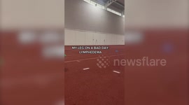 Athlete diagnosed with condition that causes swelling due to build-up of lymph fluid has her sights set on 2024 Paralympics