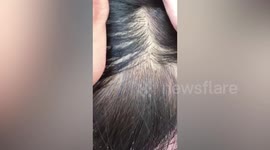 Teacher removes dozens of lice nesting in schoolgirl's hair