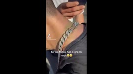 UK TikToker's neck turns green after wearing large necklace
